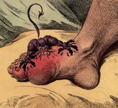  article about what is gout