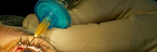 Keratoconus treatment: how about a laser eye surgery? article about Keratoconus treatment: how about a laser eye surgery?