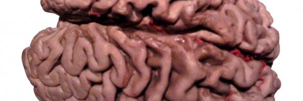 Alzheimers facts and figures article about Alzheimers facts and figures
